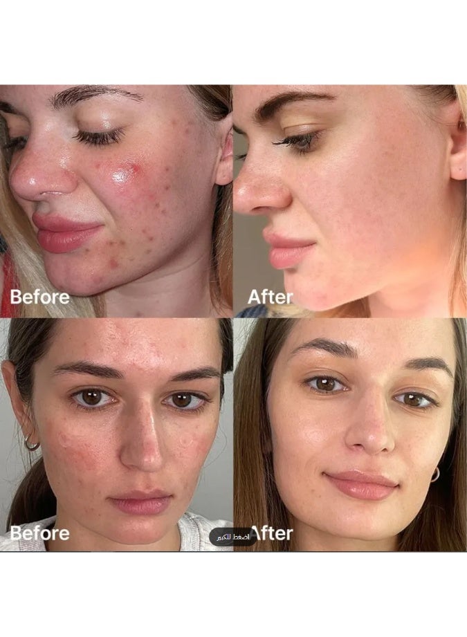 MEDICUBE-RED SUCCINIC AND CLARIFYING SERUM - Image 3